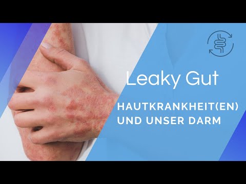 Hautkrankheit(en) und unser Darm | Die Wichtigkeit der Leaky-Gut-Heilung | André Blank – Vivoterra®