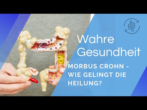 Morbus Crohn – wie gelingt die Heilung? | Schulmedizin vs. Naturheilkunde | André Blank – Vivoterra®