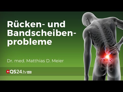 Schmerzen im Rücken: Hilflose Medizin agiert nicht ursachenbezogen! | Dr. med. M. D. Meier | QS24