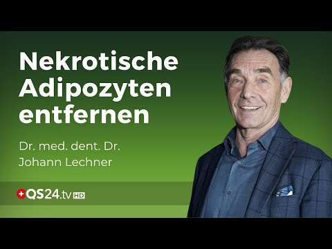 Viele chronische Krankheiten beginnen im Kiefer! | Dr. med. dent. Dr. Johann Lechner | QS24