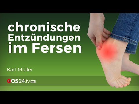 Fersensporn – Einer der häufigsten Fußprobleme | Karl Müller | Naturmedizin | QS24