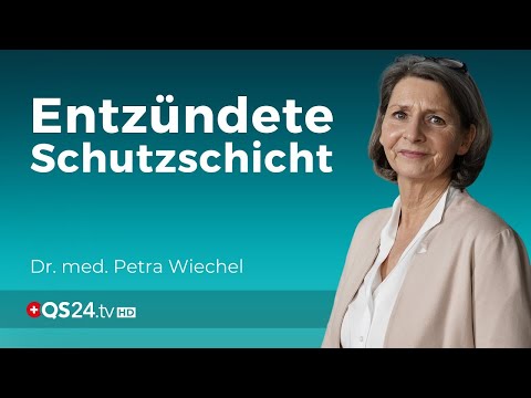 Schleimhautentzündungen – Ein Hinweis auf stille Entzündungen? | Dr. med. Petra Wiechel | QS24