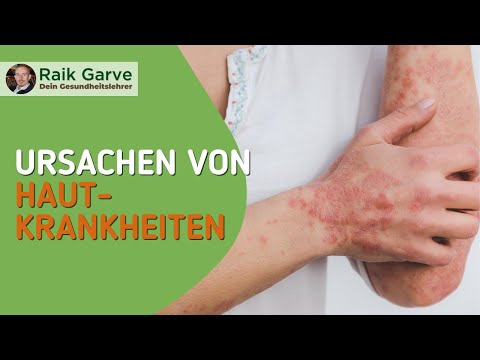 Die tieferliegenden Ursachen von Hautkrankheiten enthüllt