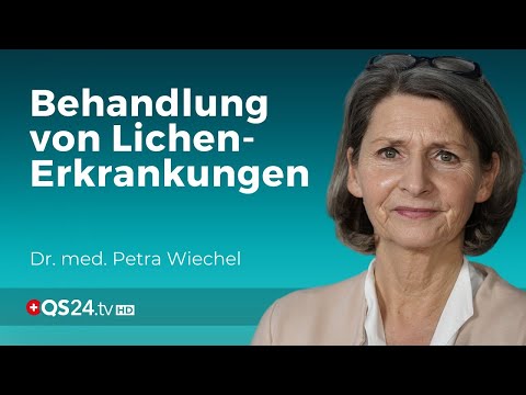 Lichen-Erkrankungen: Ist die Behandlung mit Cortisonsalbe genug? | Dr. med. Petra Wiechel | QS24