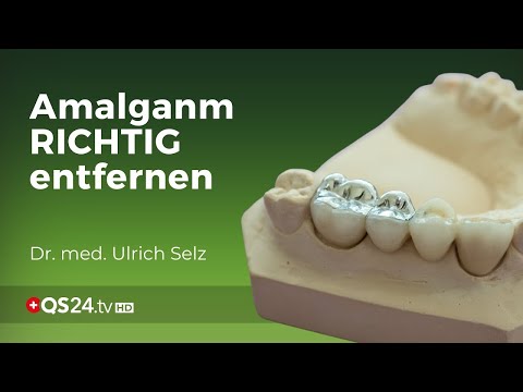 Fatale Fehler der Amalgamentfernung | Dr. med. Ulrich Selz | Erfahrungsmedizin | QS24