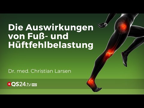 Knieprobleme vermeiden: Die Bedeutung von Fuß- und Hüftausrichtung | Dr. Christian Larsen | QS24