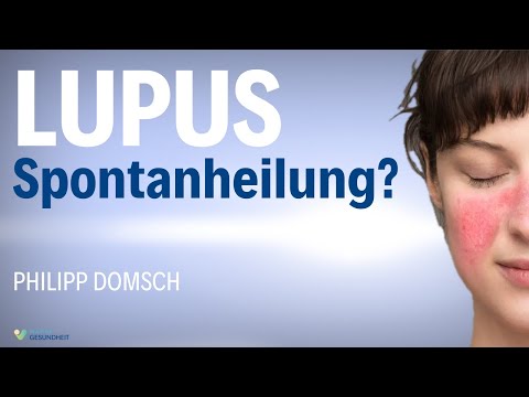 Lupus Erythematodes besiegt? Einblicke in eine Spontanheilung – Philipp Domsch