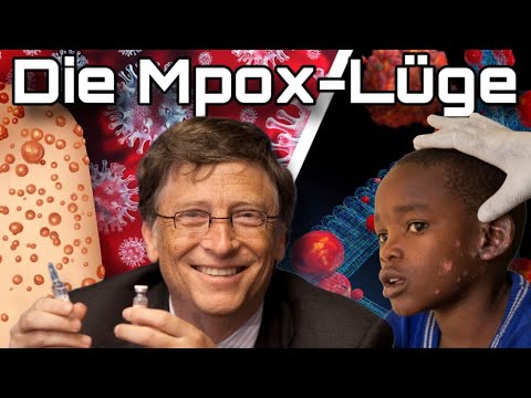 Die Mpox-Lüge: Dieser Plan steckt hinter dem Ausbruch