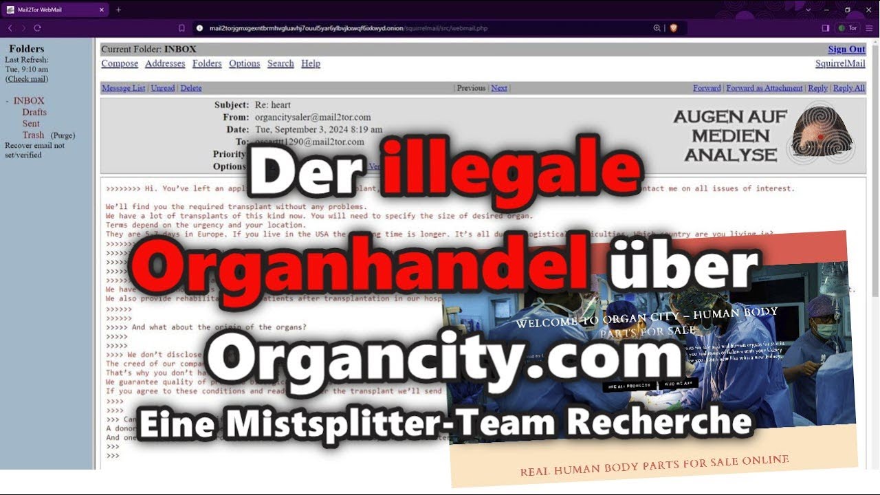 Der illegale Organhandel über Organcity.com – Eine Mistsplitter-Team Recherche (Video-Podcast)