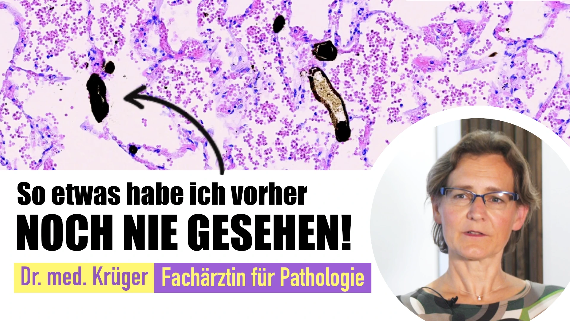 Fakten auf den Tisch! Schwedische Pathologin liefert Beweise zu Corona-Impfschäden. Interview mit Dr. med. Ute Krüger