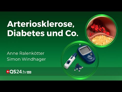 Arteriosklerose, Diabetes und Co.: Arno Wolle’s Antwort auf Wohlstandserkrankungen  | QS24