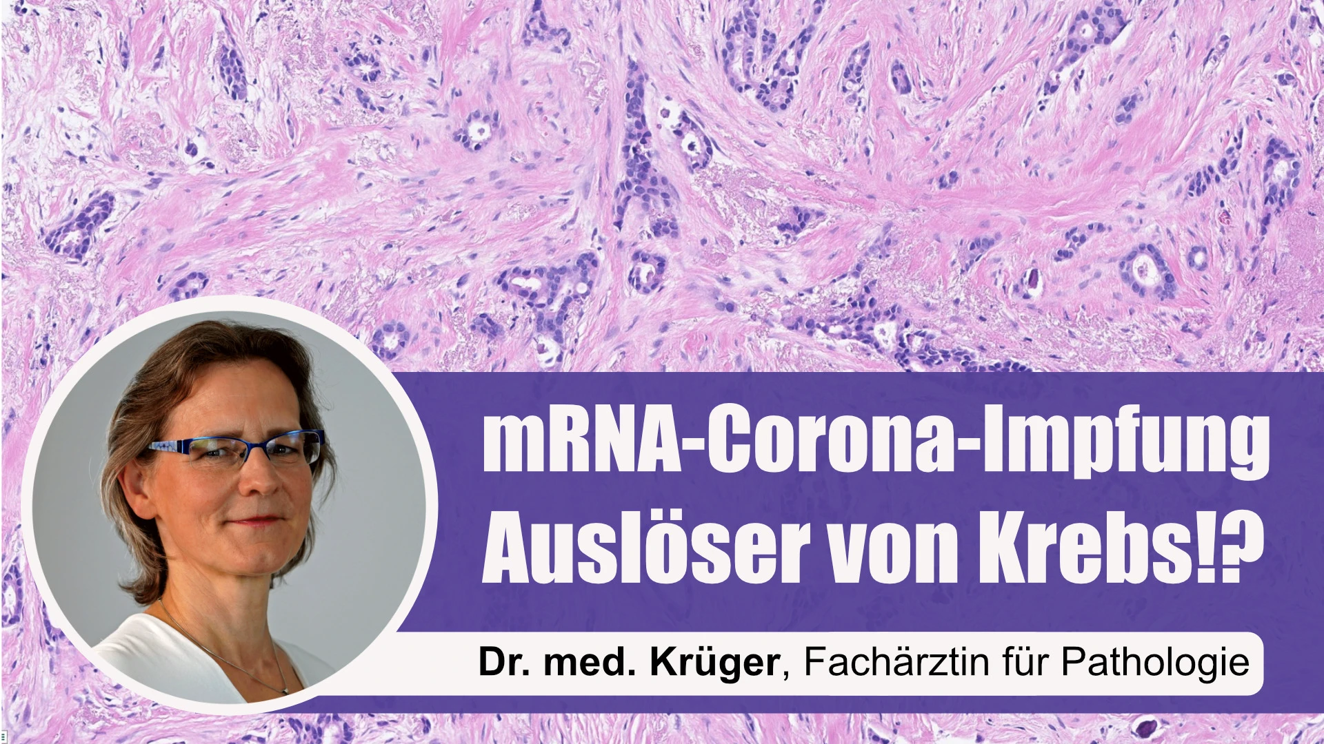 mRNA-Corona-Impfung – Auslöser von Krebs/Turbokrebs!? Interview mit Frau Dr. med. Ute Krüger