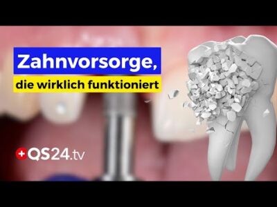 Mehr über den Artikel erfahren Periimplantitis: Wie Sie sich schon 10 Jahre im Voraus schützen können | Naturmedizin | QS24