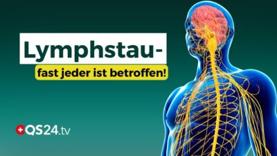 Mehr über den Artikel erfahren Lymphstau löst Krankheiten aus! So aktivieren Sie Ihr Lymphsystem | Erfahrungsmedizin | QS24