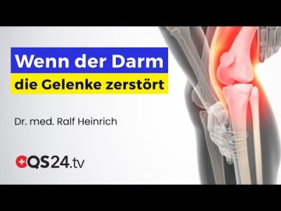 Mehr über den Artikel erfahren Leaky Gut & Gelenkschäden – Wie der Darm die Heilung beeinflusst | Naturmedizin | QS24