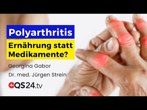 Polyarthritis: Ein Blick auf alternative Therapien und Ernährung | Erfahrungsmedizin | QS24
