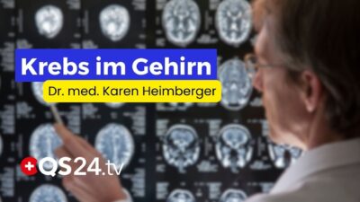 Mehr über den Artikel erfahren Hirntumoren: Welche Therapien wirklich helfen können | QS24