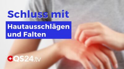 Mehr über den Artikel erfahren Ihre Hautprobleme sind kein Fluch – sie sind die Lösung! | Erfahrungsmedizin | QS24