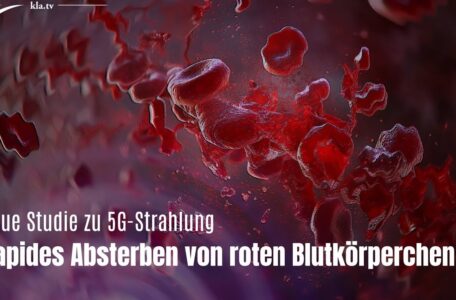 Rote Blutkörperchen werden durch 5G-Strahlung schwer geschädigt (Neue Studie)