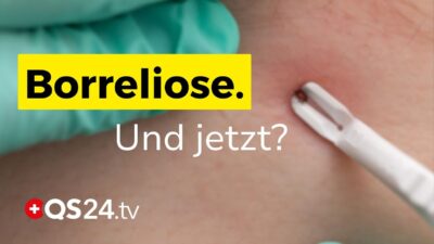 Mehr über den Artikel erfahren Zeckenstich, Wanderröte und die Angst vor Borreliose | Dr . med. Petra Wiechel | Visite | QS24