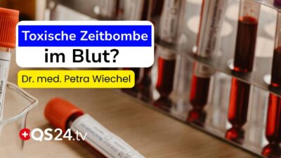 Mehr über den Artikel erfahren Blutwäsche 2.0: Der Durchbruch gegen stille Entzündungen & Co?  | Naturmedizin | QS24