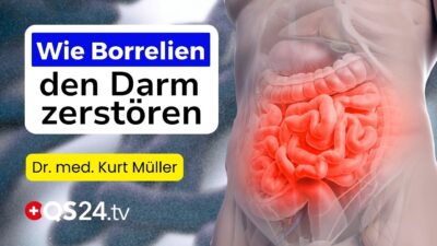Mehr über den Artikel erfahren Borreliose – Die unterschätzte Ursache vieler Darmkrankheiten? | Dr. med. Kurt Müller | QS24 Gremium
