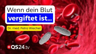 Mehr über den Artikel erfahren Toxinausleitung über das Blut – so funktioniert Hämoadsorption | Naturmedizin | QS24
