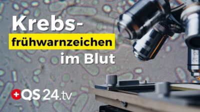 Mehr über den Artikel erfahren Hautkrebs erkannt – bevor er sichtbar war! | Erfahrungsmedizin | QS24 Gesundheitsfernsehen