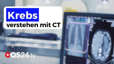 Mehr über den Artikel erfahren Wie ein Hirn-CT die wahre Ursache einer Krebserkrankung sichtbar machte | Erfahrungsmedizin | QS24