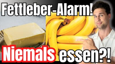 Mehr über den Artikel erfahren 8 GEFÄHRLICHE Nahrungsmittel für Fettleber (+gute Alternativen!)