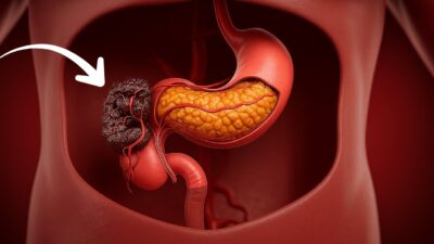 Mehr über den Artikel erfahren 98% aller deiner Krankheiten VERSCHWINDEN wenn du diese Gesundheitsmythen kennst