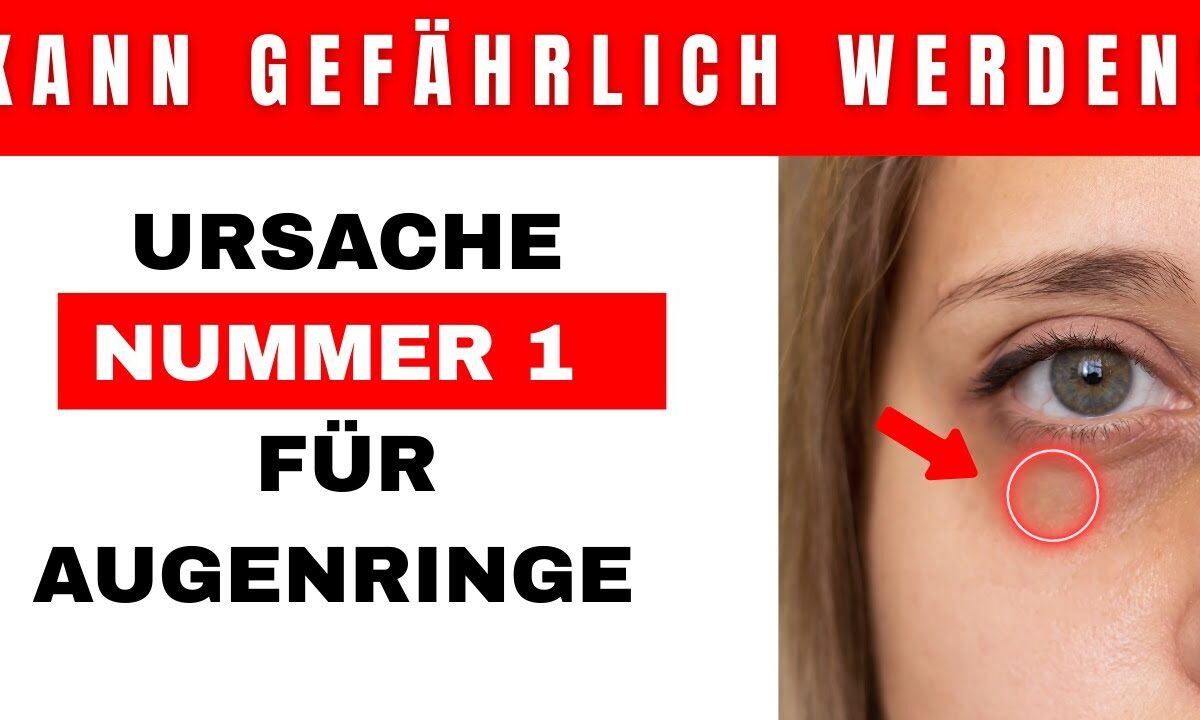 Augenringe und Falten SOFORT loswerden (Es geht so einfach)