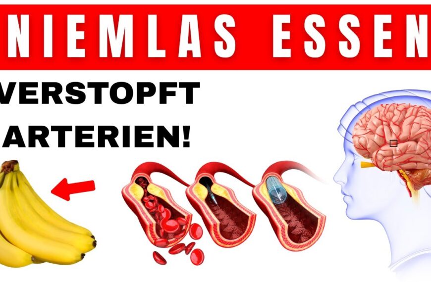 Diese Bekannten Lebensmittel verstopfen deine Arterien VERMEIDE SIE UNBEDINGT und esse lieber