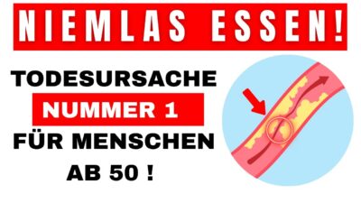 Mehr über den Artikel erfahren Diese Produkte VERSTOPFEN deine Arterien Vermeide sie unbedingt!