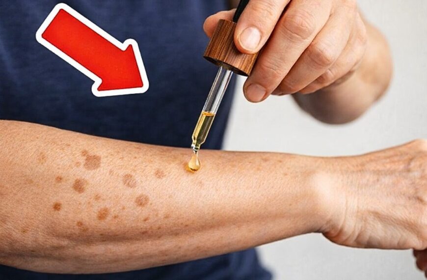 Altersflecken einfach weg? Dieses Mittel sorgt gerade für riesiges Staunen