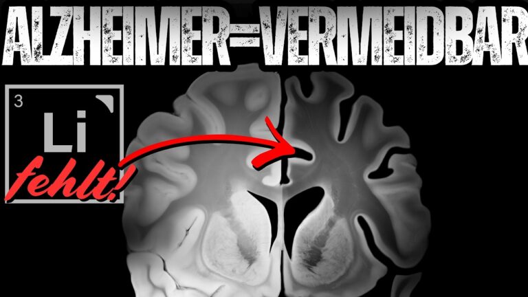 Mehr über den Artikel erfahren Alzheimer vermeiden – warum Lithium der Schlüssel ist