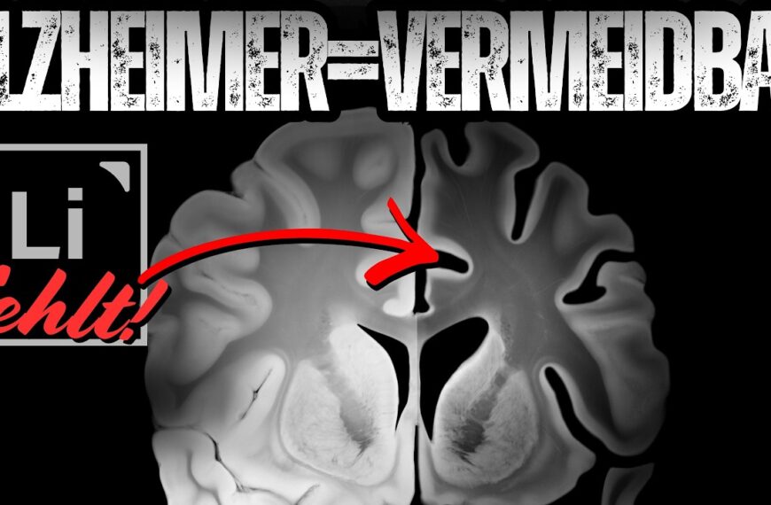 Alzheimer vermeiden – warum Lithium der Schlüssel ist