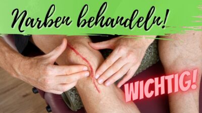 Mehr über den Artikel erfahren Narbe verklebt, verhärtet oder empfindlich? 5 Techniken zur Selbstbehandlung